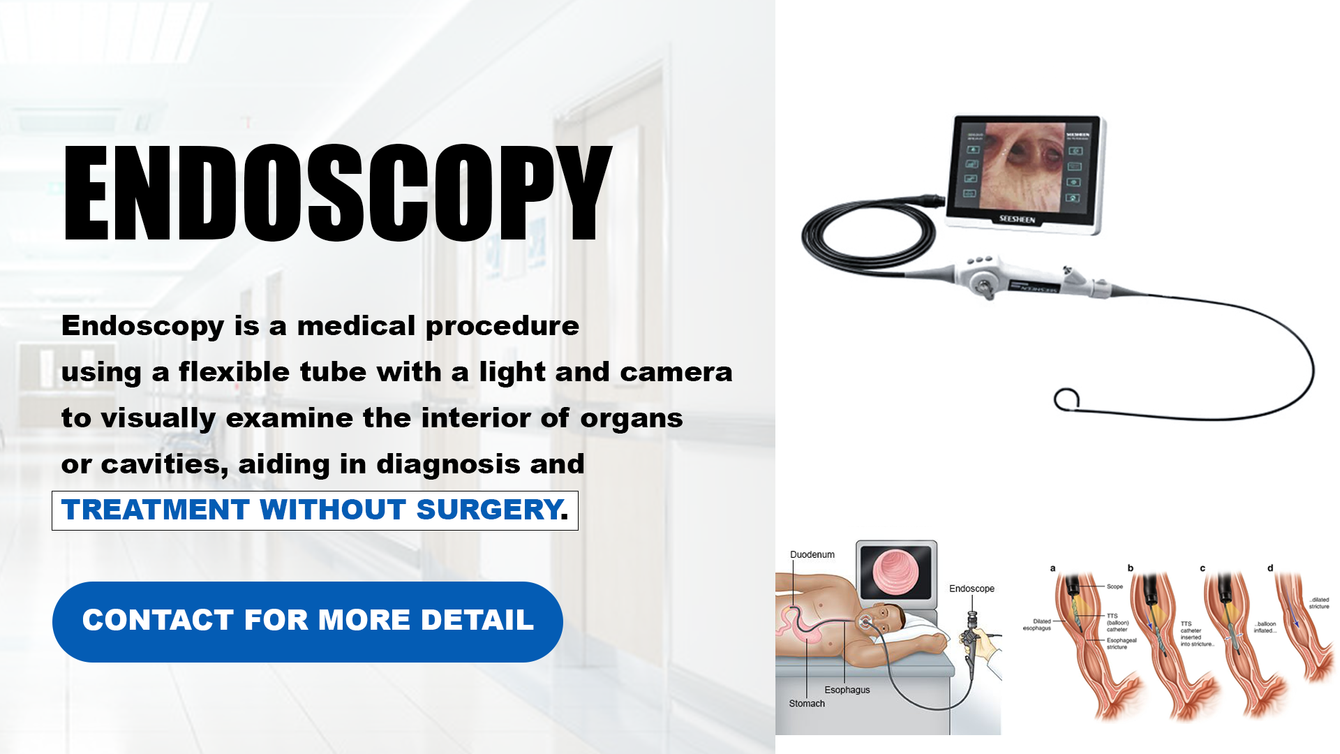 endoscopy