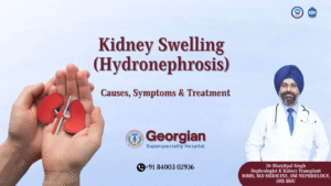 Kidney Swelling Causes, Symptoms and Treatment in Varanasi